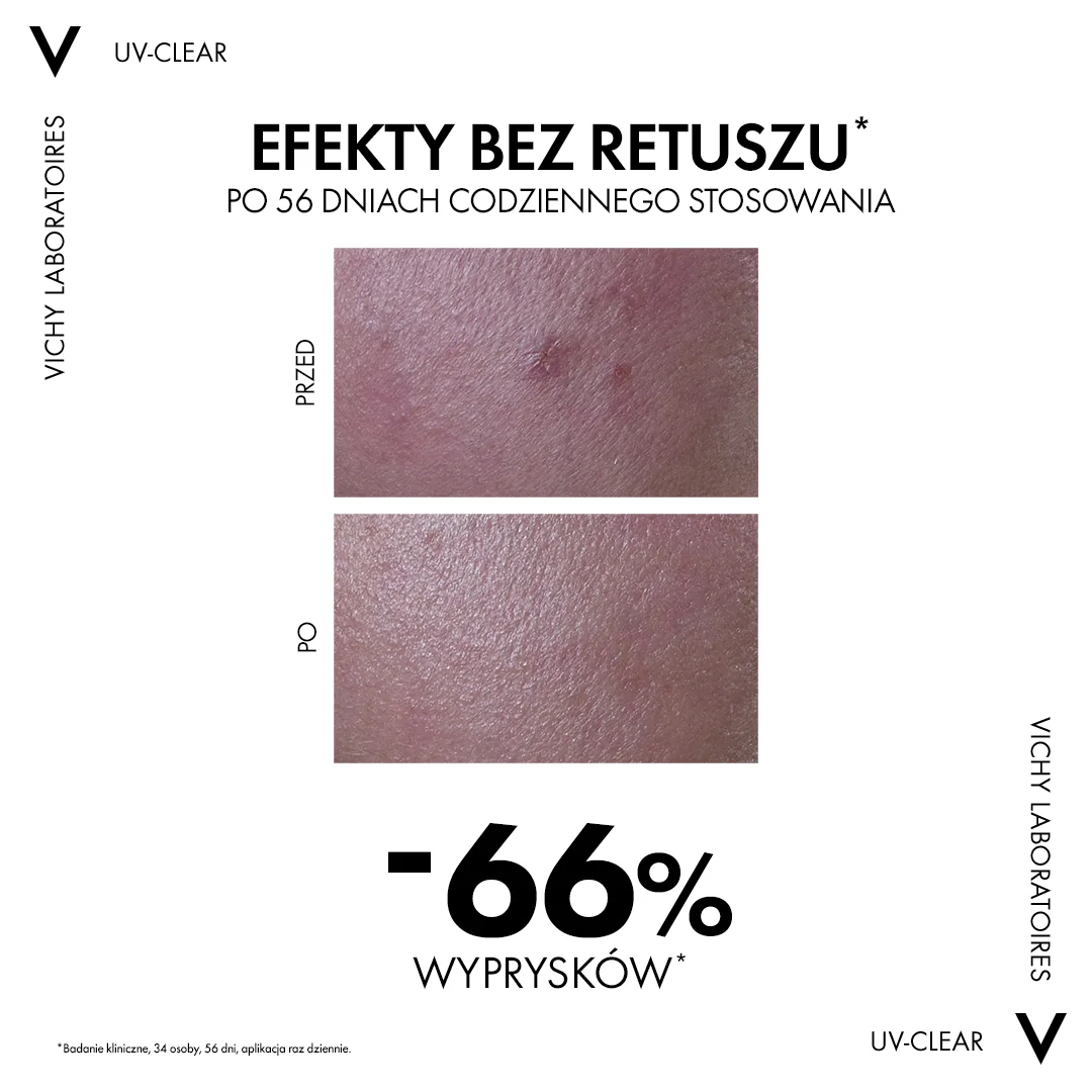 Vichy Capital Soleil UV-Clear fluid przeciw niedoskonałościom SPF 50+, 40 ml