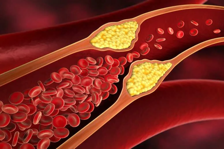 Co to jest cholesterol? Co to jest cholesterol?