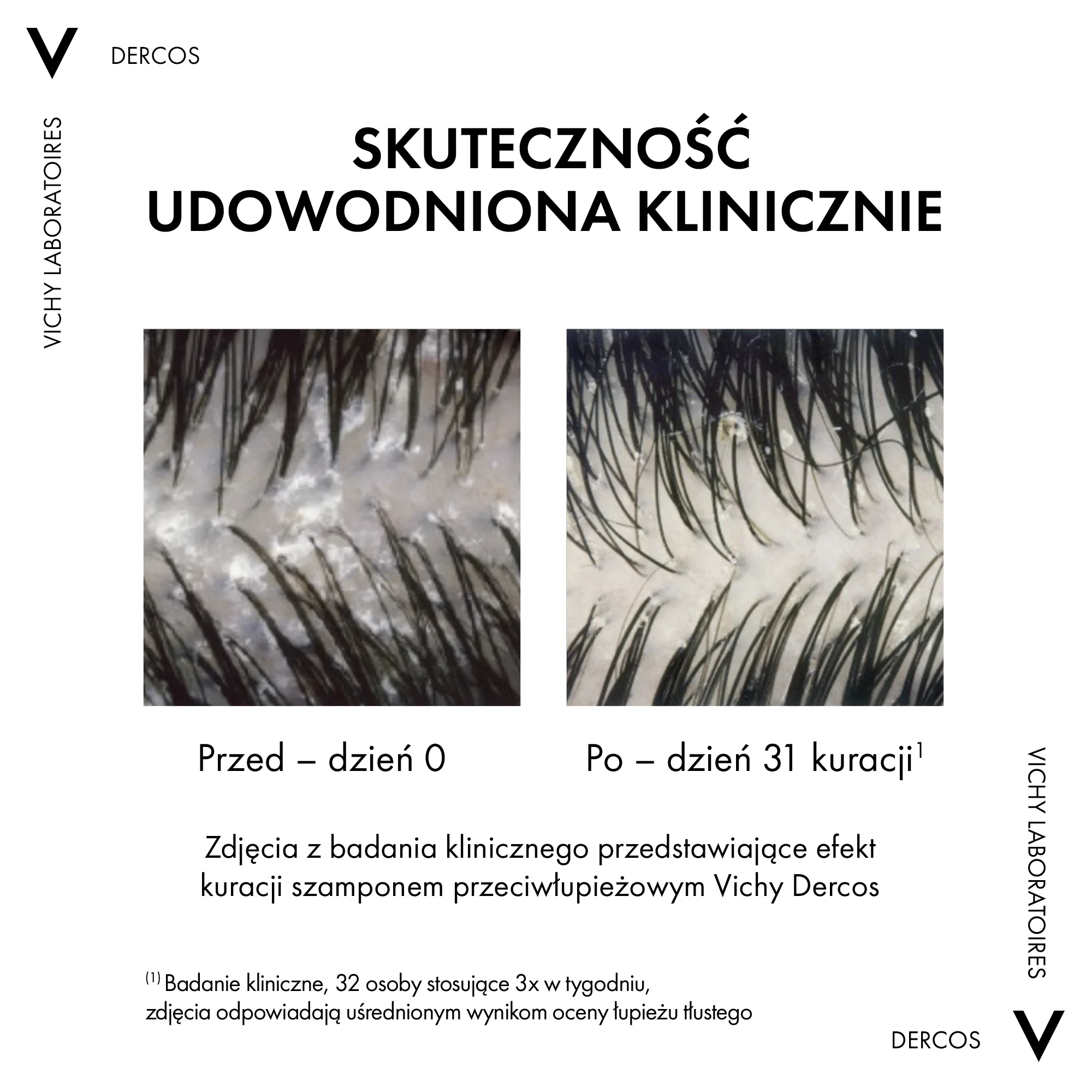 Vichy Dercos Szampon przeciwłupieżowy, włosy normalne i przetłuszczające się, 390 ml