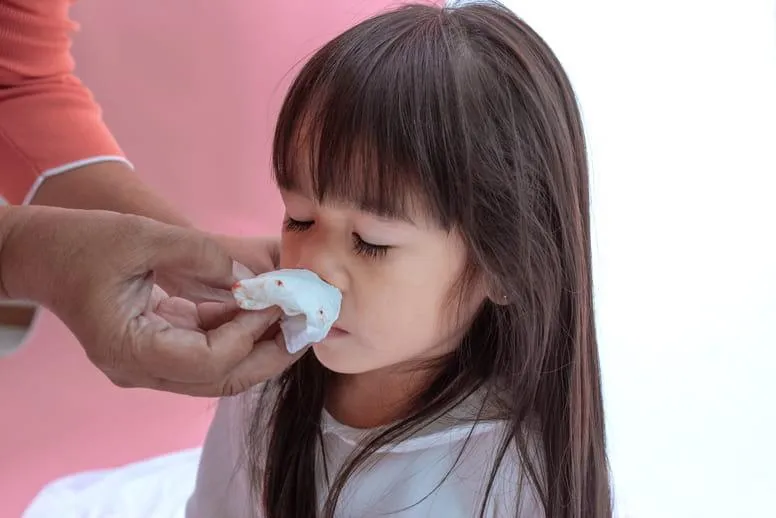 Krew z nosa u dziecka - przyczyny, leczenie i pierwsza pomoc
