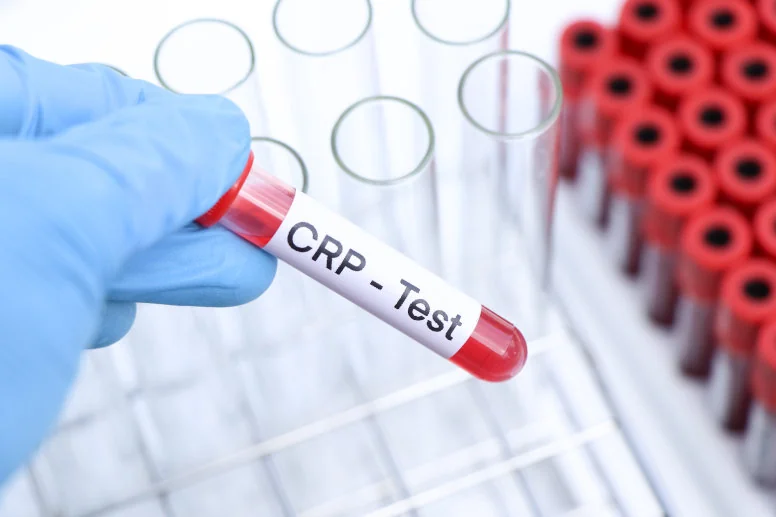 test crp test crp
