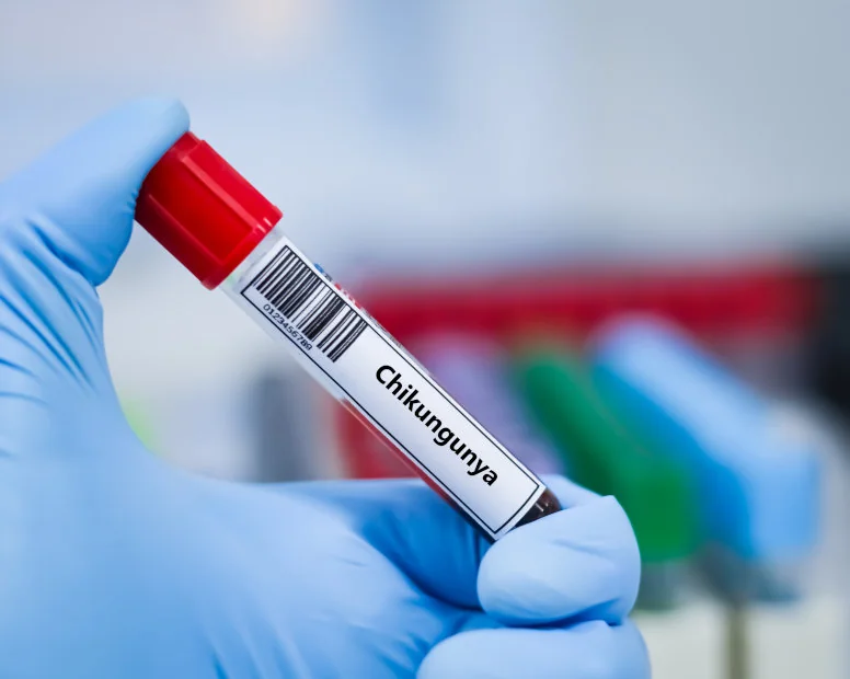 Szczepionka na chikungunya – kto powinien się zaszczepić?