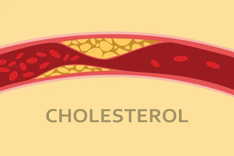 Cholesterol – normy wiekowe 