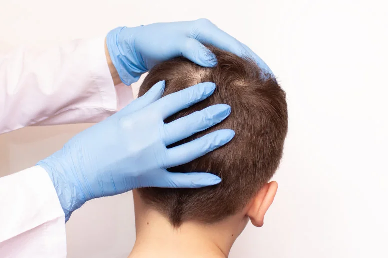swędząca skóra głowy diagnostyka swędząca skóra głowy diagnostyka