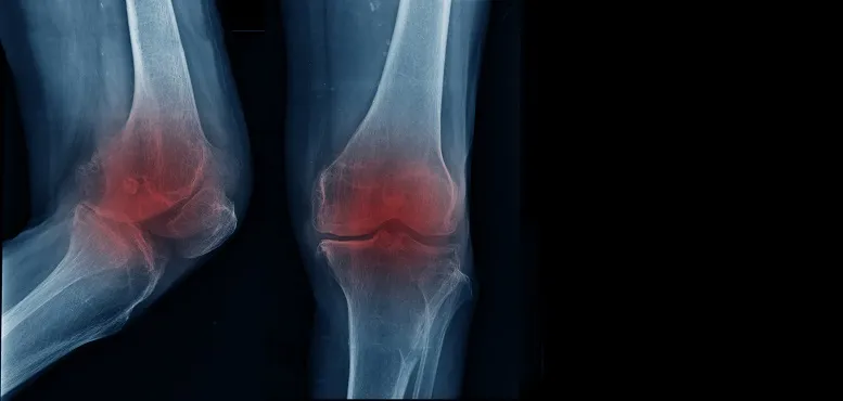 ból i strzykanie w kolanie
