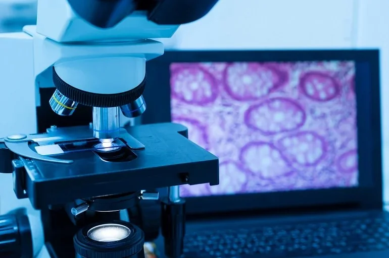 Biopsja skóry – na czym polega? Biopsja skóry – na czym polega?