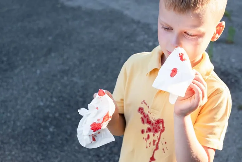 Krew z nosa u dziecka leczenie