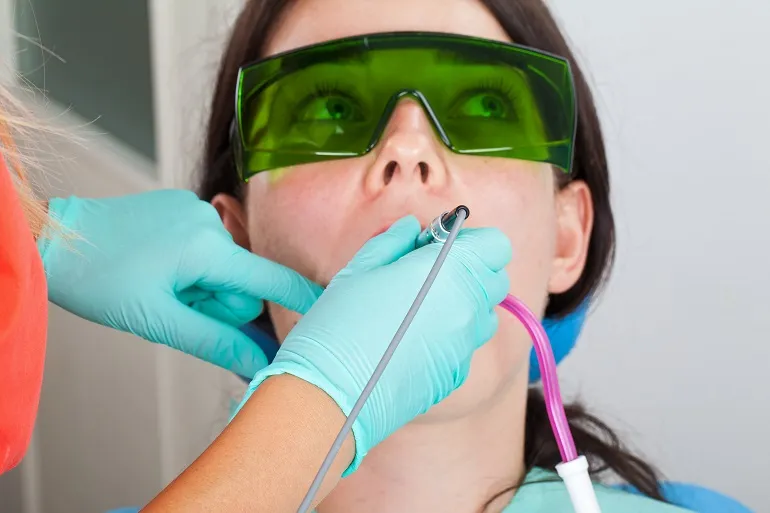 laserowe usuwanie zębów