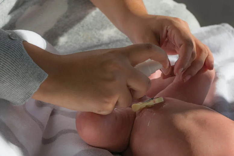 Jak często pielęgnować pępek noworodka? Jak często pielęgnować pępek noworodka?