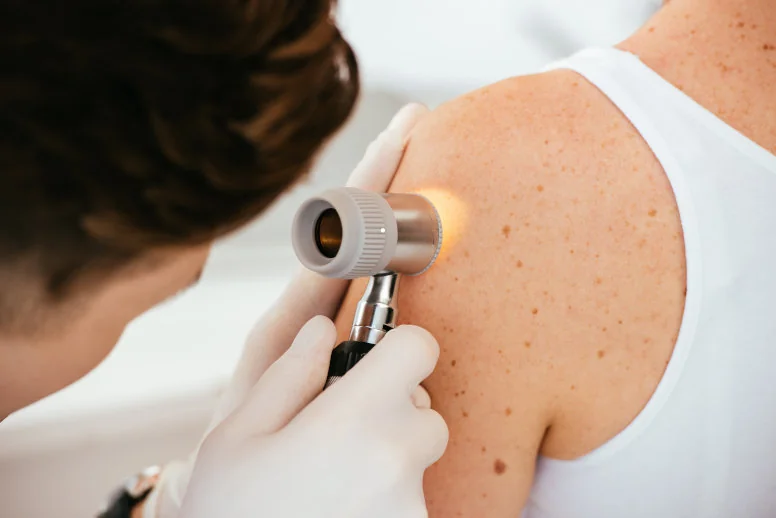 dermatoskopia - jak wygląda dermatoskopia - jak wygląda
