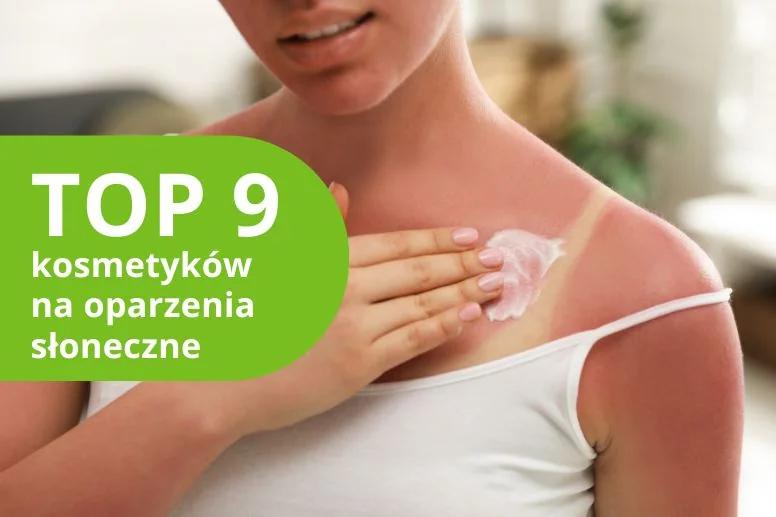 TOP kosmetyki na oparzenia słoneczne! Ranking 2026