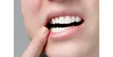 Rany w jamie ustnej – przyczyny, leczenie i domowe sposoby