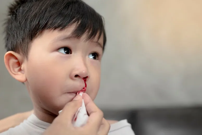 Krew z nosa u dziecka przyczyny