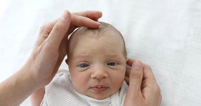 tipos de fontanela en un bebe