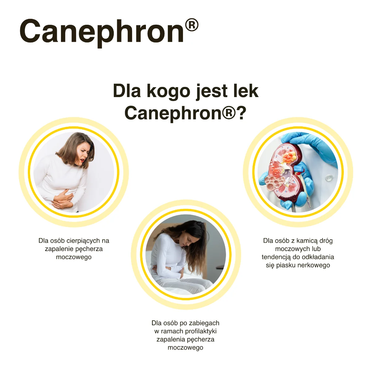 Canephron 0,018g+0,018g+0,018g