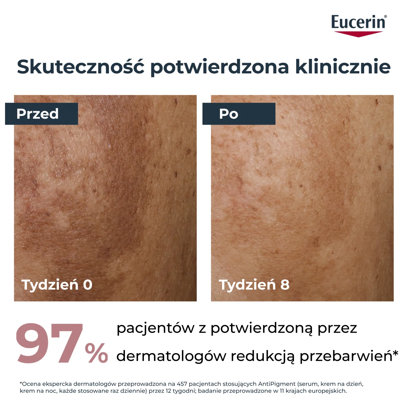 Eucerin Anti-Pigment serum o podwójnym działaniu z Thiamidolem przeciw przebarwieniom, 30 ml