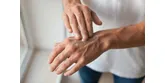 Atopowe zapalenie skóry dłoni −  jak je pielęgnować? Te składniki aktywne Ci pomogą!