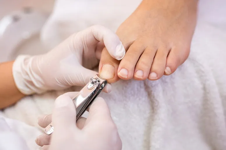 Jak obciąć twarde paznokcie u nóg