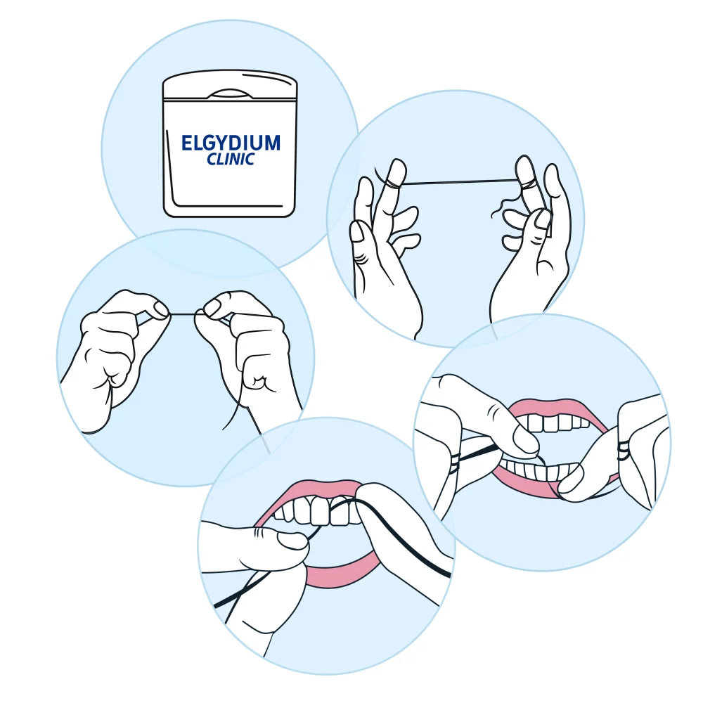 Elgydium Clinic nić dentystyczna z fluorem, 1 sztuka