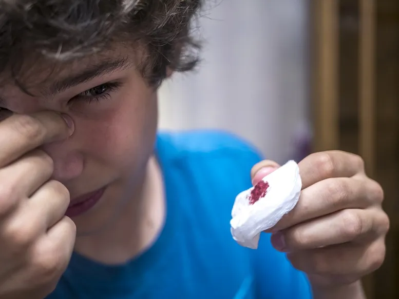 chłopiec z krwotokiem z nosa