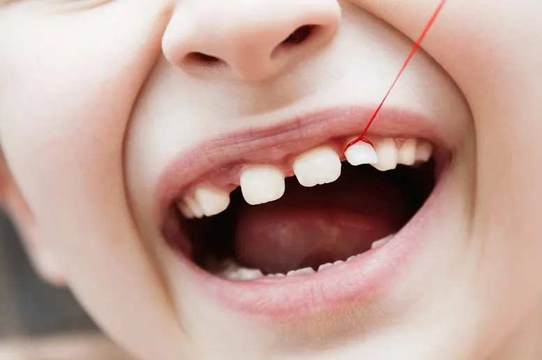 objawy wypadania zębów mlecznych