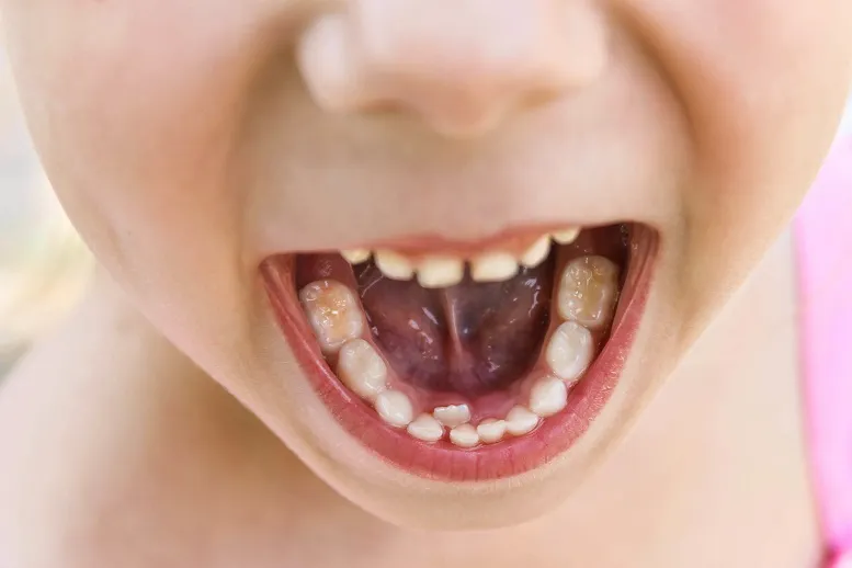 kolejność wypadania zębów mlecznych