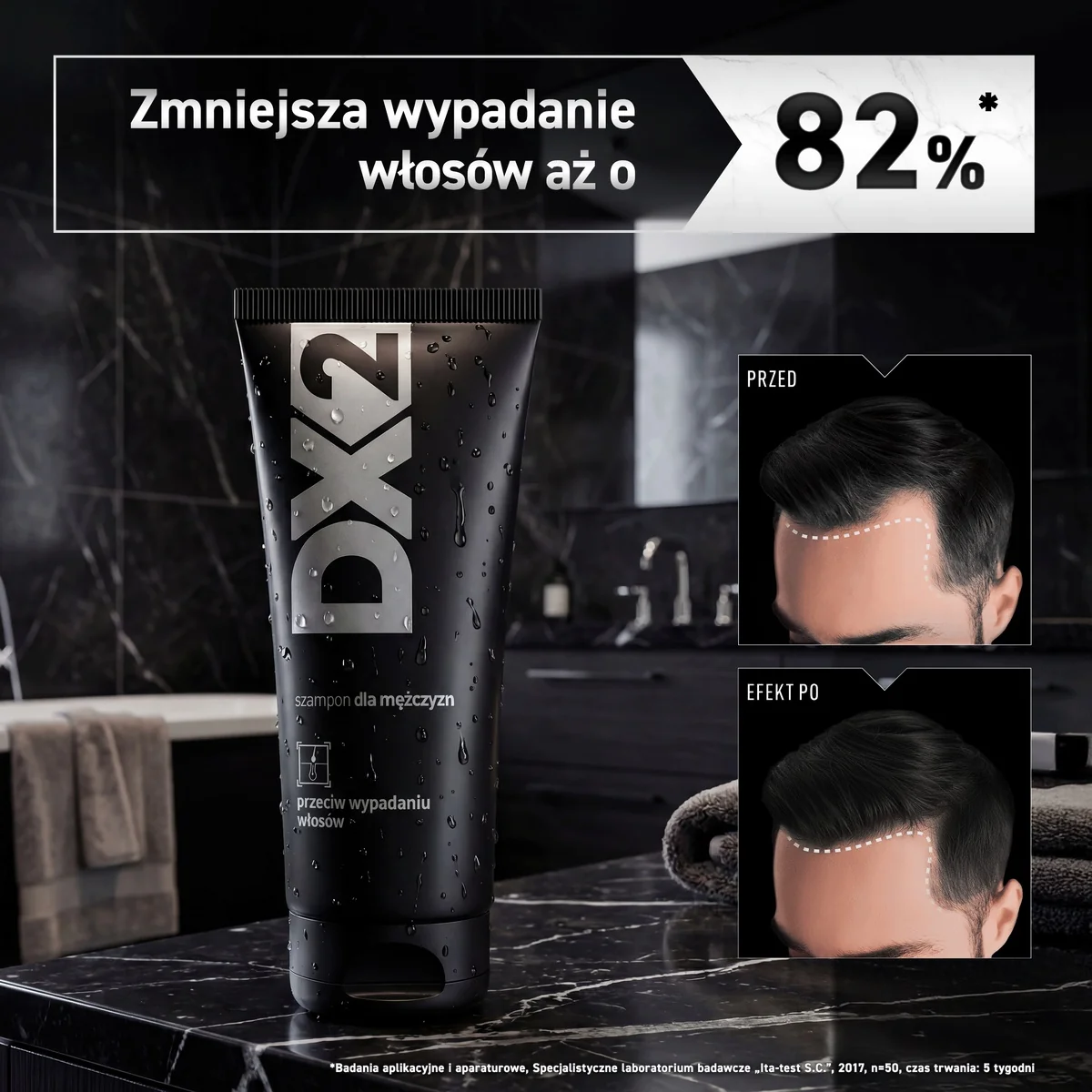 DX2 szampon dla mężczyzn przeciw wypadaniu włosów, 150 ml
