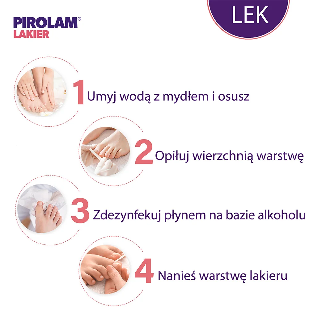 Pirolam Lakier 80 mg/g, lakier do paznokci leczniczy, 4g