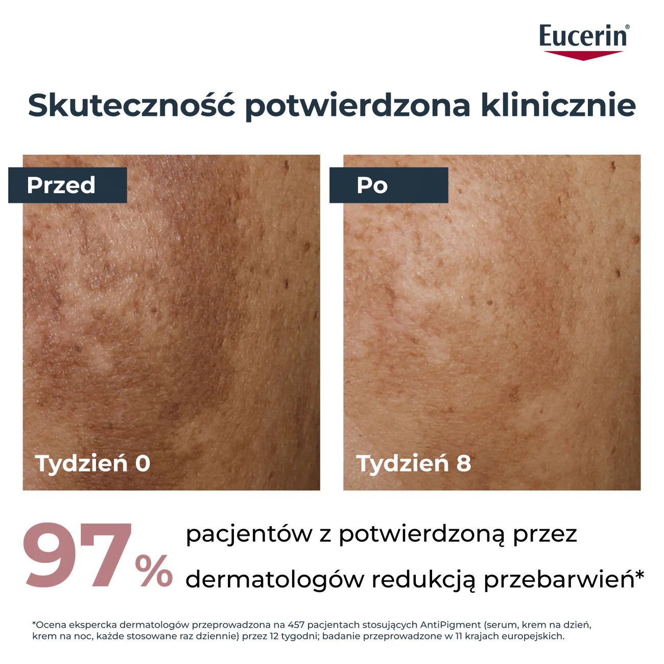 Eucerin Anti-Pigment antypigmentacyjny krem do twarzy na noc, 50 ml