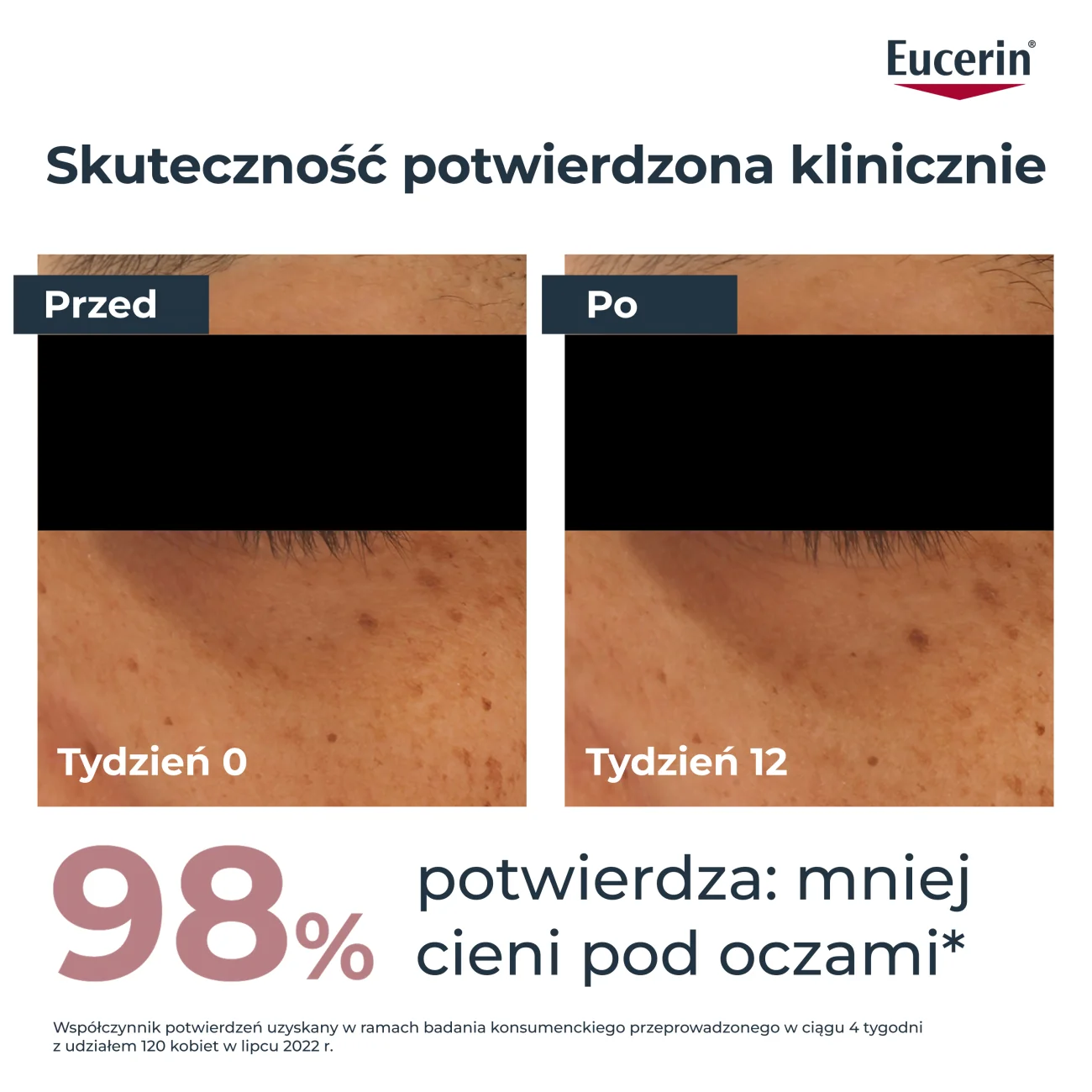 Eucerin Anti-Pigment, Krem pod oczy rozjaśniający cienie pod oczami, 15 ml
