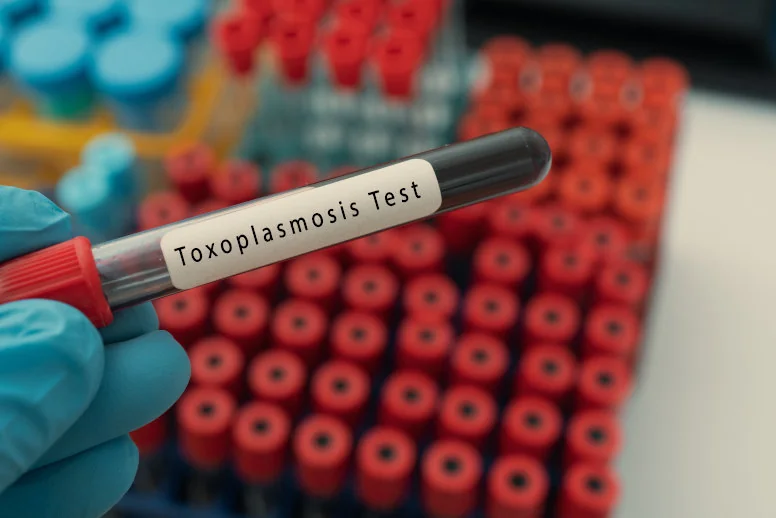 test na toksoplazmozę test na toksoplazmozę