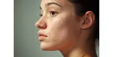 Kaszka na twarzy – jakie są przyczyny i jak się jej pozbyć?