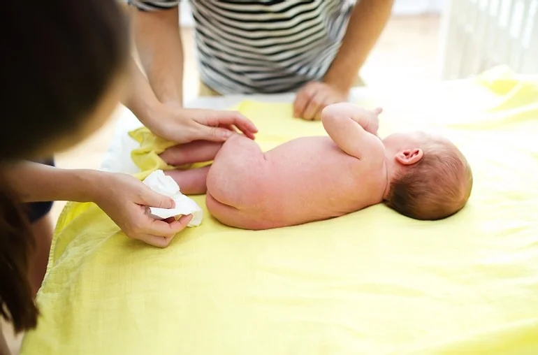 zaczerwieniona pupa u dziecka zaczerwieniona pupa u dziecka