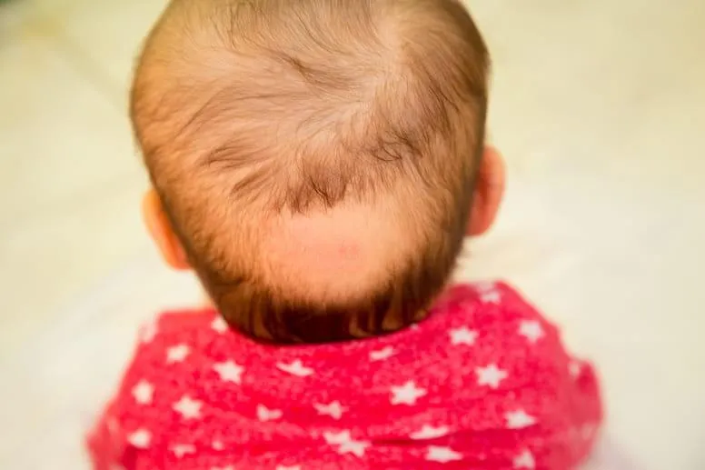 Wypadanie włosów u dzieci – przyczyny, objawy, leczenie