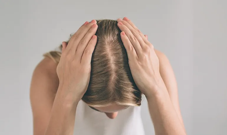 ¿Por qué se cae el cabello después del embarazo?