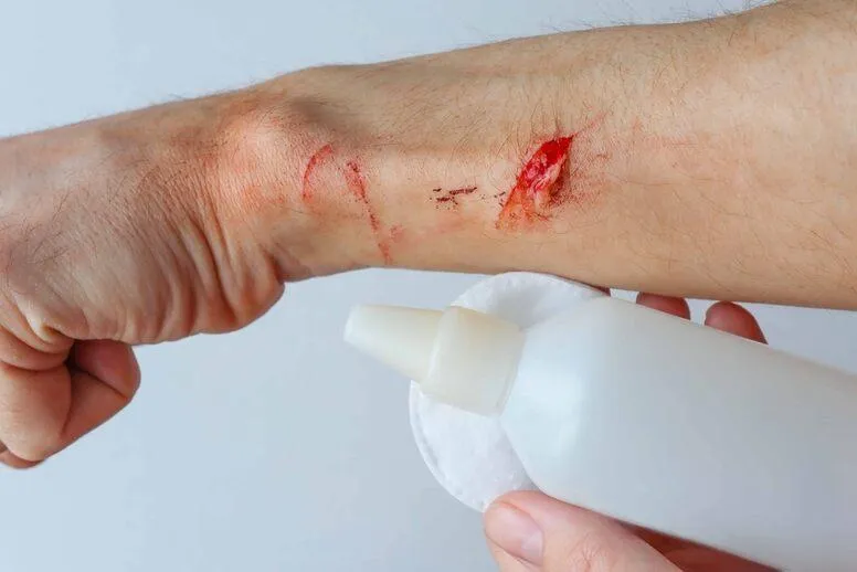 Odkażanie ran – jak i czym dezynfekować rany?
