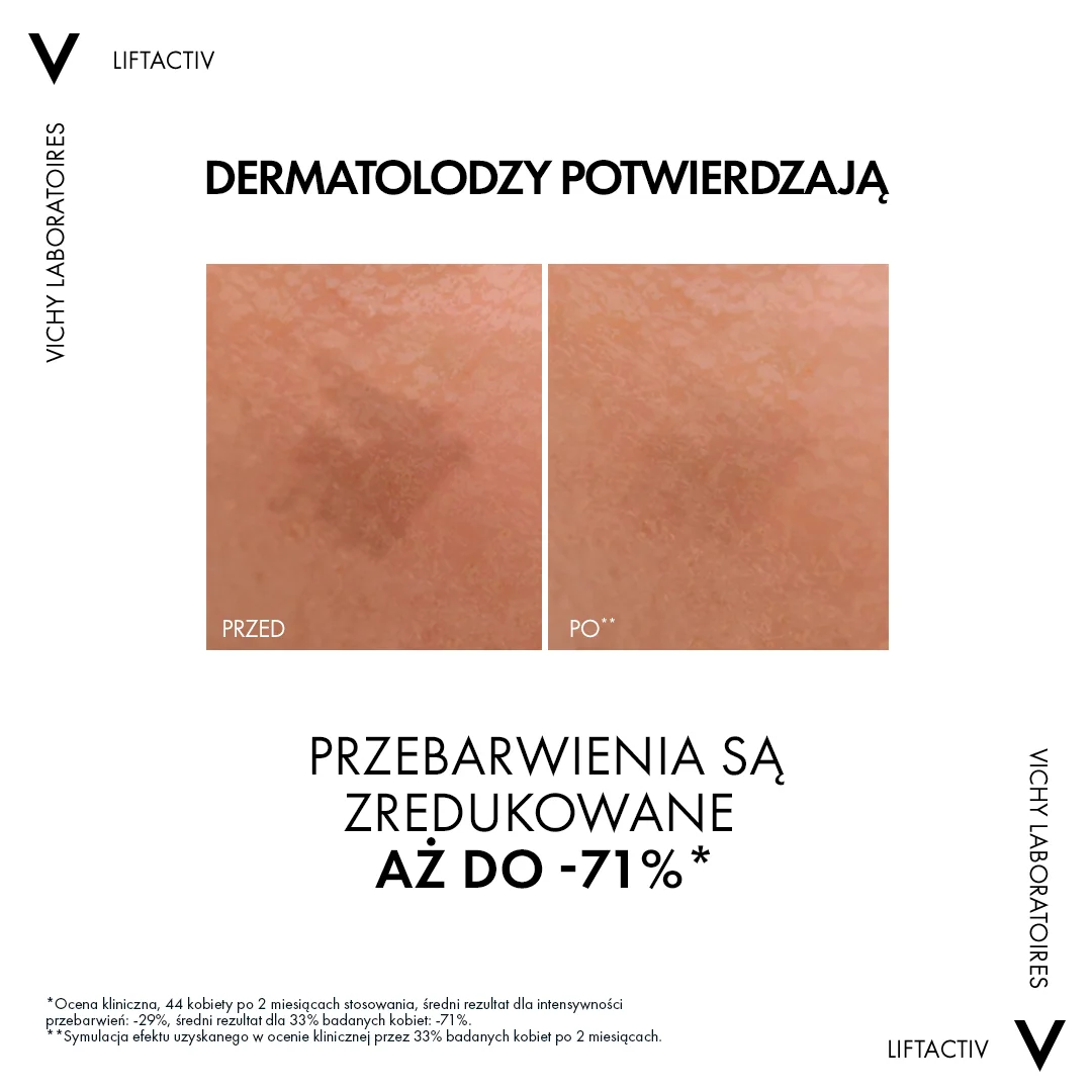 Vichy Liftactiv Specialist B3 serum redukujące przebarwienia i zmarszczki, 30 ml
