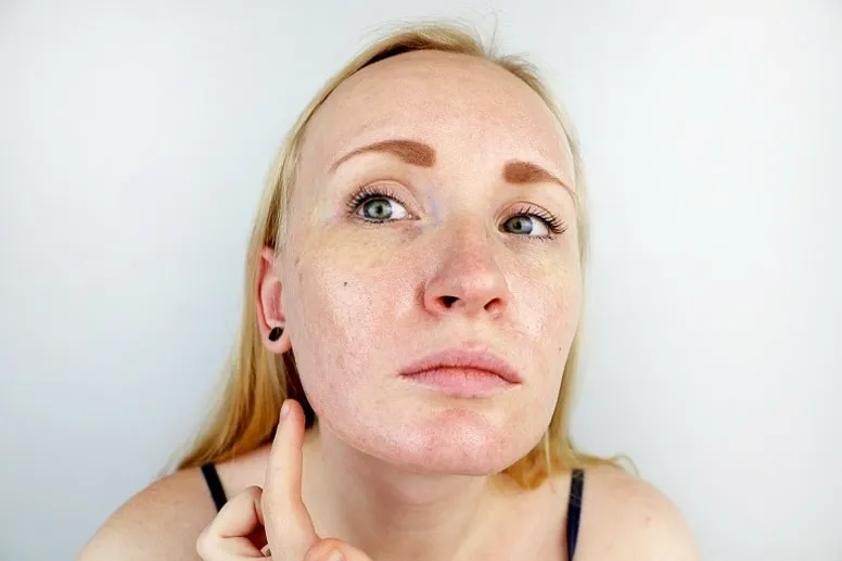 Jak zmniejszyć wydzielanie sebum Jak zmniejszyć wydzielanie sebum