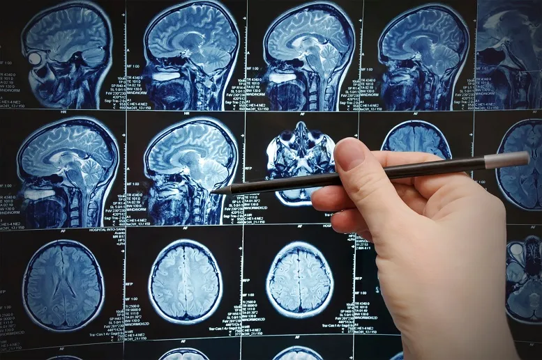 tomografia komputerowa czaszki