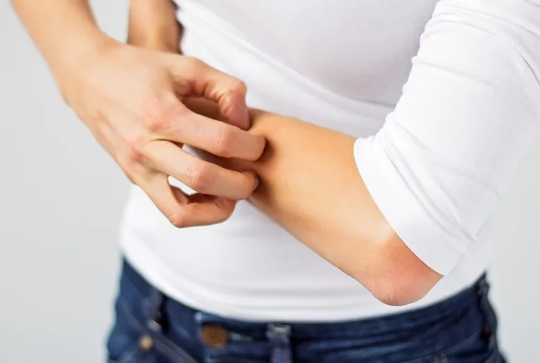 Choroby alergiczne skóry – z czym najczęściej przychodzimy do dermatologa?