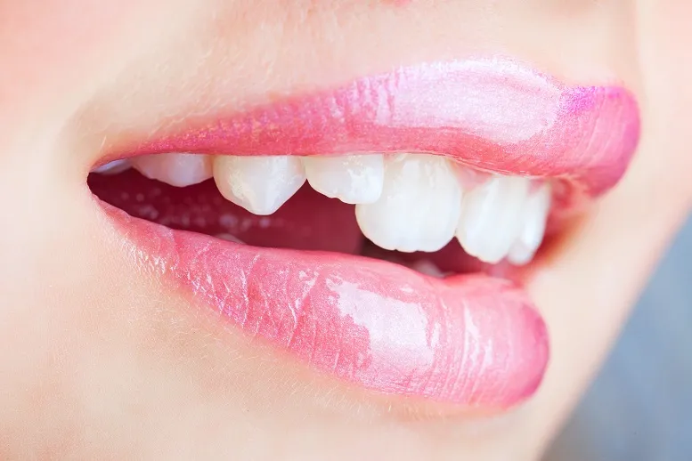 Hiperdoncja − skąd biorą się dodatkowe zęby w buzi i jak się je leczy?