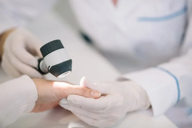 Kapilaroskopia - na czym polega diagnostyka mikrokrążenia?