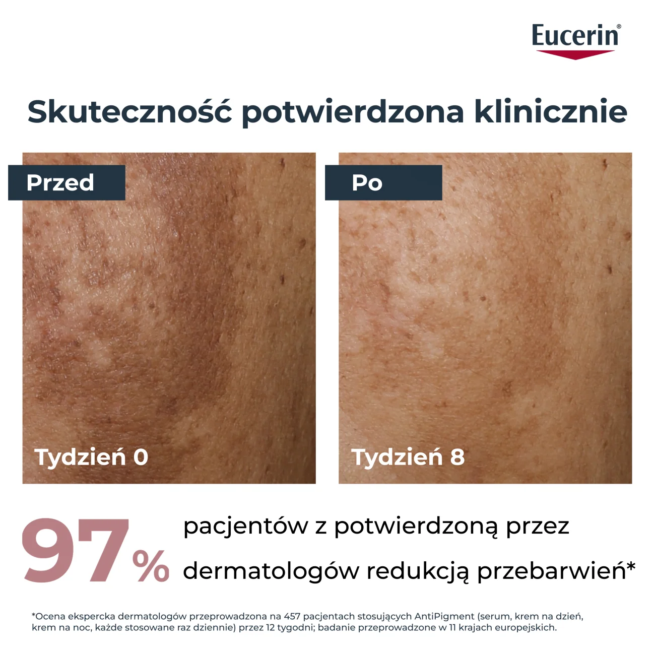 Eucerin Anti-Pigment antypigmentacyjny krem do twarzy na dzień SPF 30, 50 ml