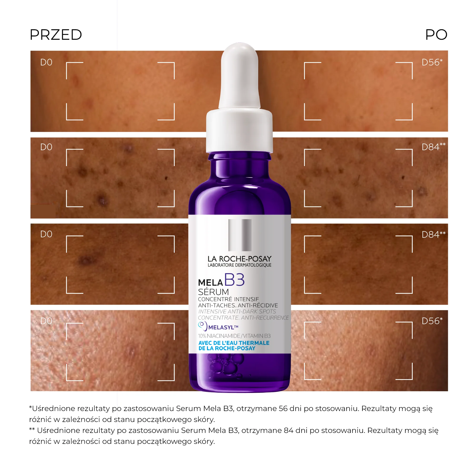 LA ROCHE-POSAY MELA B3 serum przeciw przebarwieniom, 30 ml