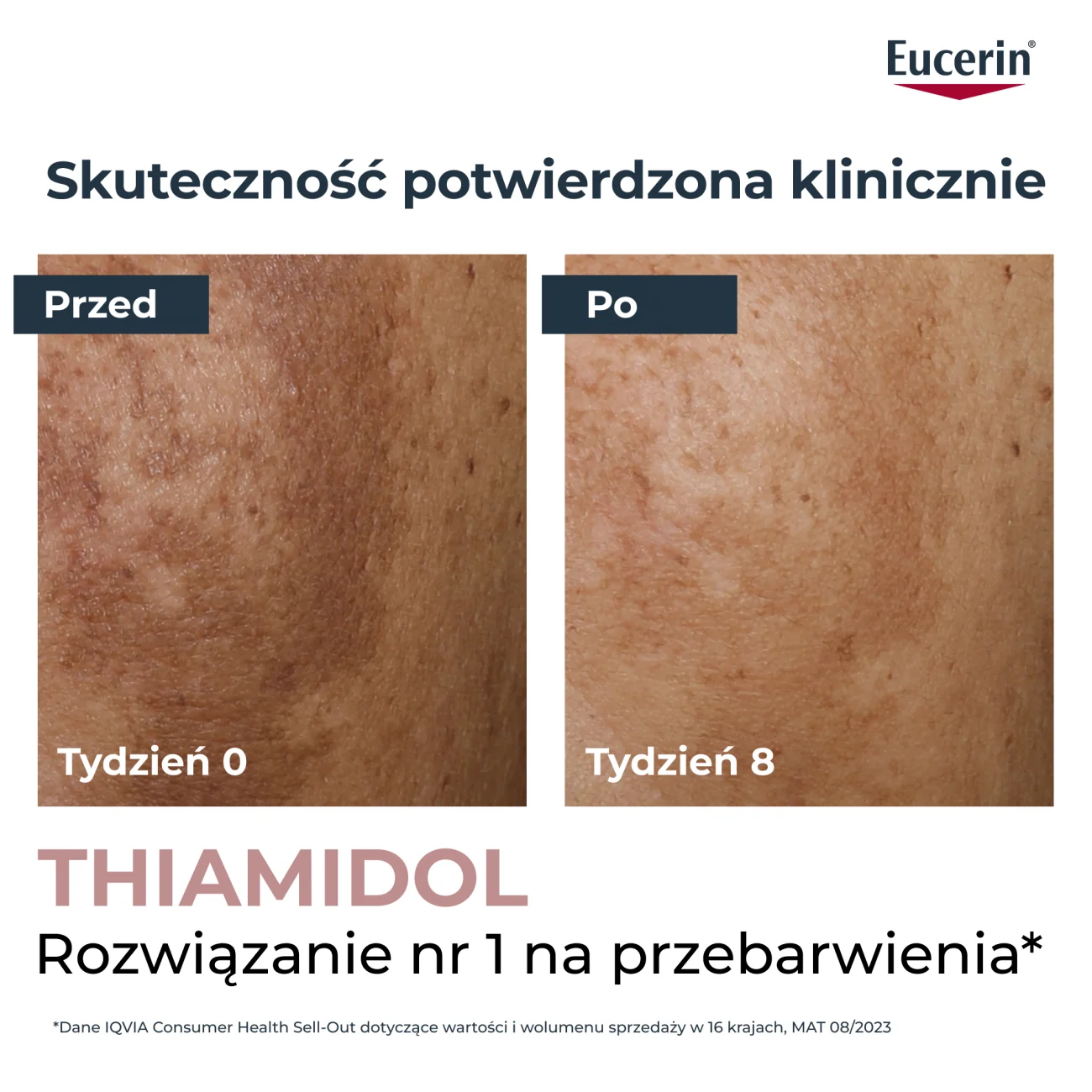 Eucerin Anti-Pigment korektor punktowy z Thiamidolem przeciw przebarwieniom, 5 ml