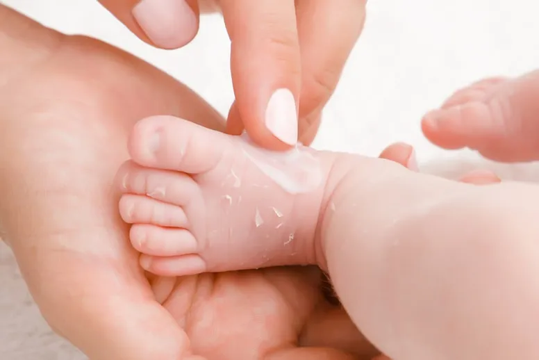 Schodząca skóra na stopach u dziecka leczenie