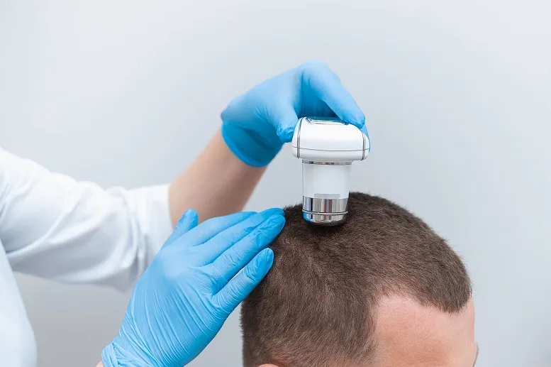 Trichoskopia − jak wygląda badanie włosa?