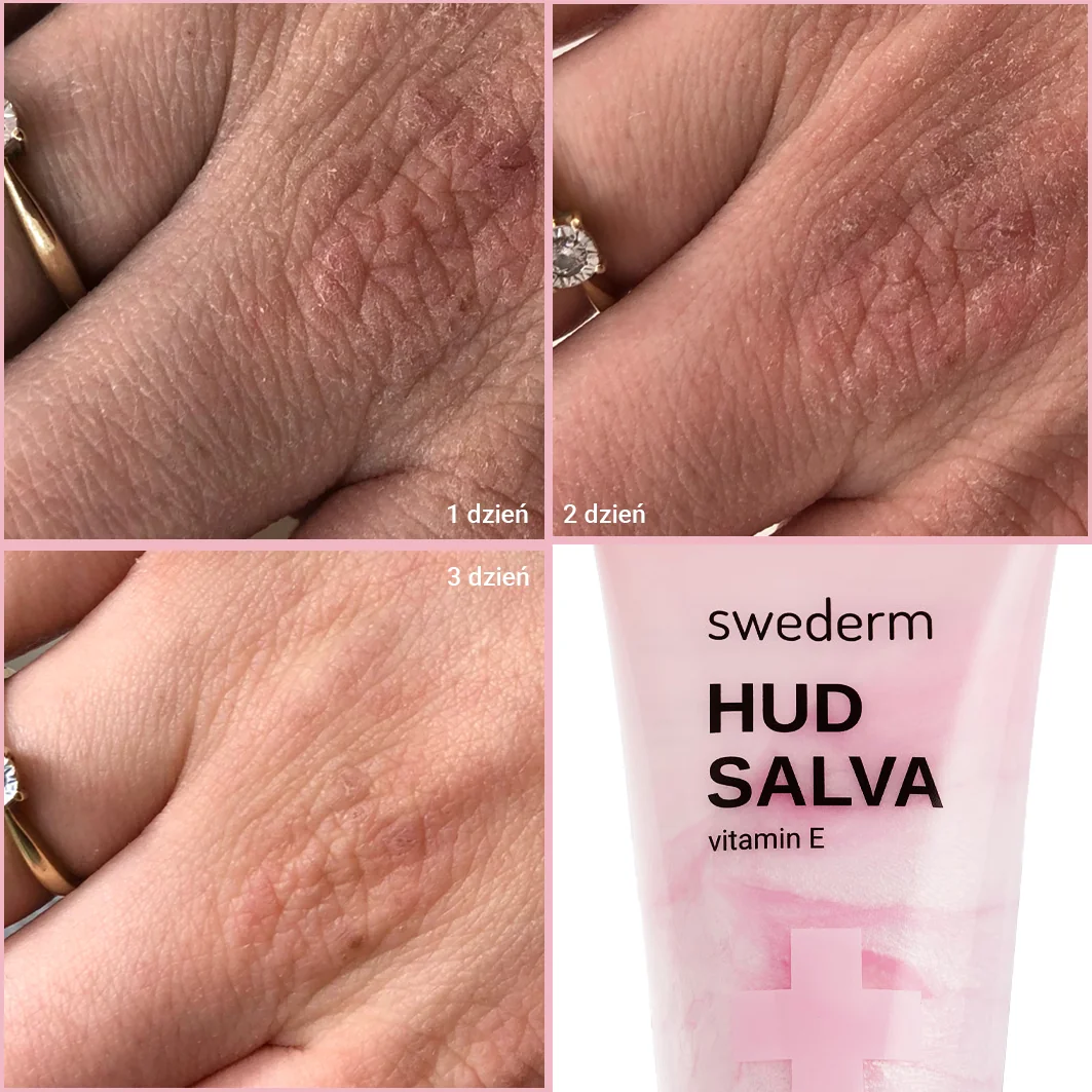 Swederm Hudsalva Vitamin E krem do rąk, 50 ml