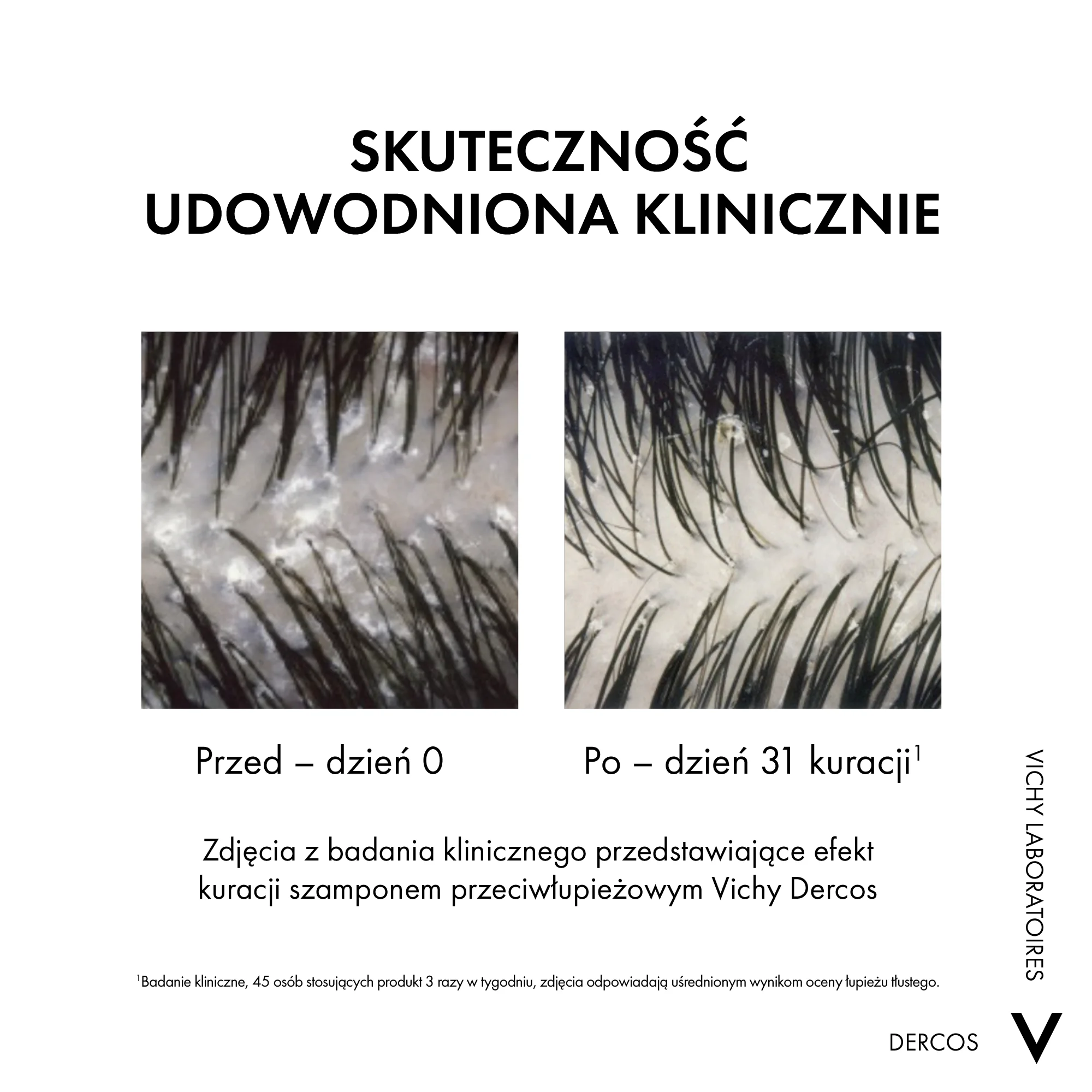 VICHY DERCOS Szampon Przeciwłupieżowy z odżywką 2w1, 200ml