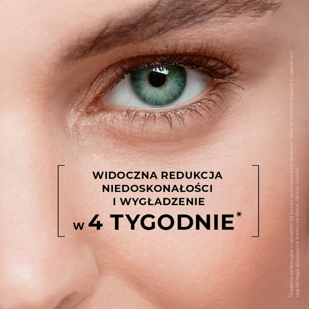 L'biotica Estetic Clinic ACID Treatment wygładzająco-nawilżający dermo-zabieg krem na dzień SPF 30, 35 ml